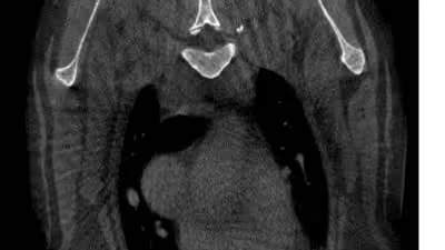 Sample CT scan image during image reading analysis